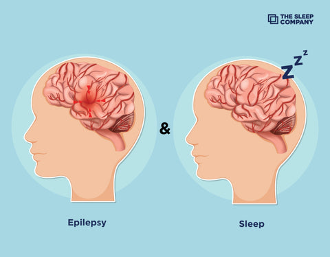 Epilepsy and Sleep: Understanding The Connection Between The Two